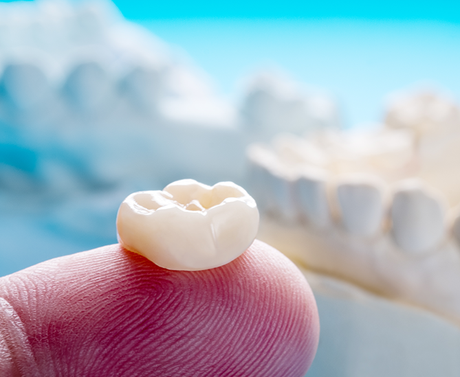 Bruxism Treatment Appointment at Smile Clinic London 