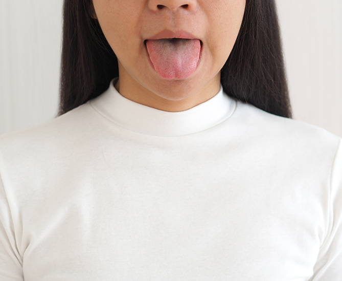 Causes of Geographic Tongue in UK