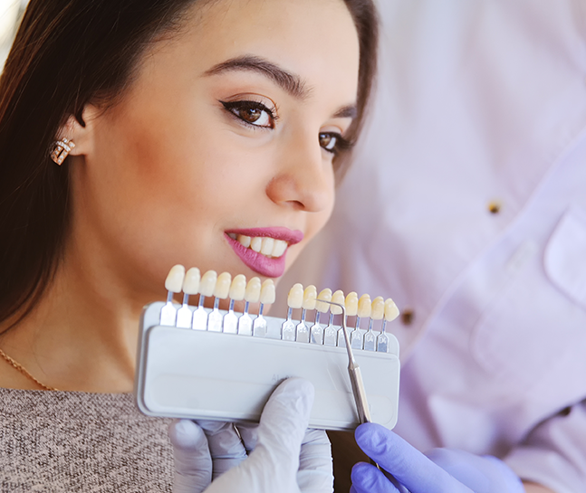 Composite Veneers in London