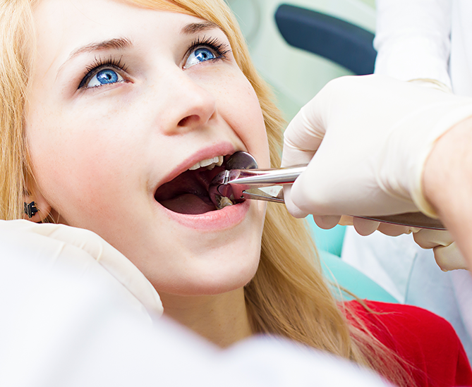 Dental Abscess Treatments in London