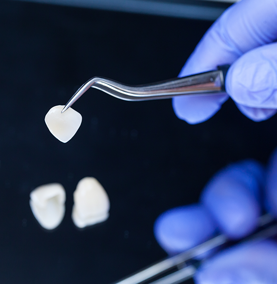Dental Crowns cost in London