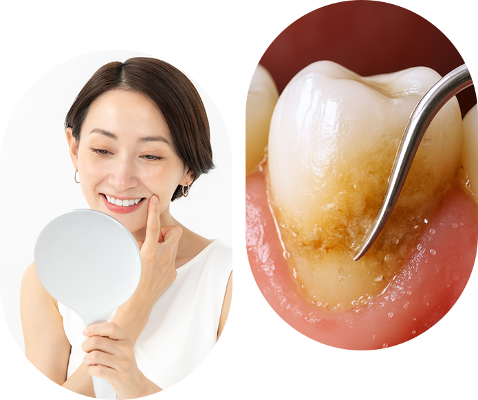 Periodontal Disease Treatment in London.