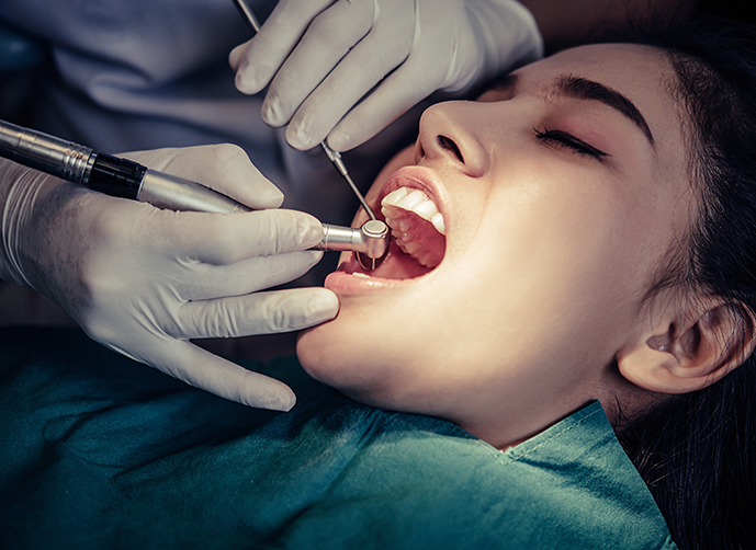 Root Canal Treatment in London at Smile Clinic London