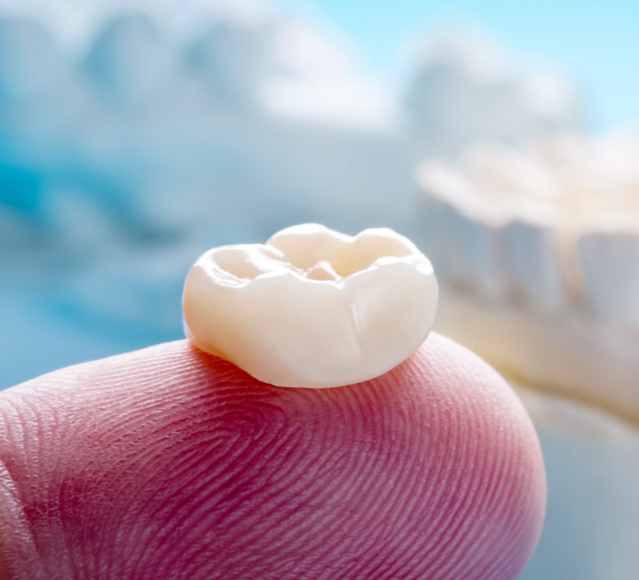 Single tooth implant cost in London