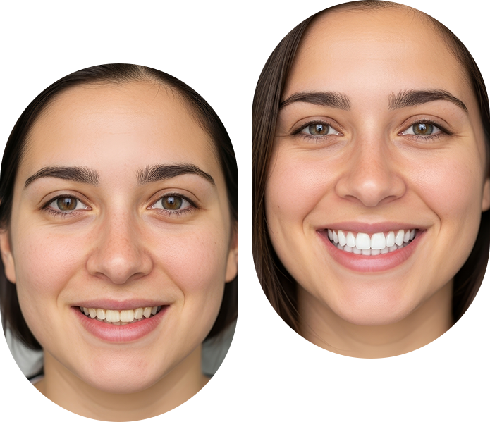 Smile makeover treatment in London