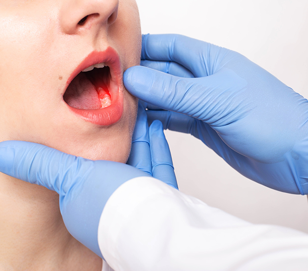 Symptoms of tooth abscess in London