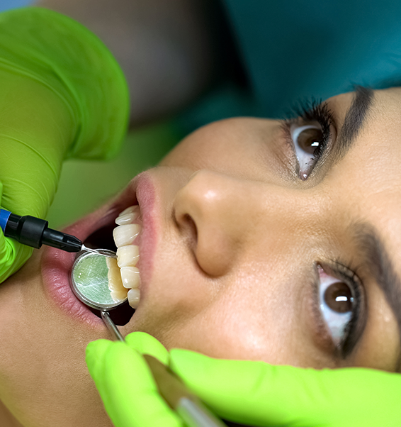 Chipped Tooth Repair Treatment Cost in London