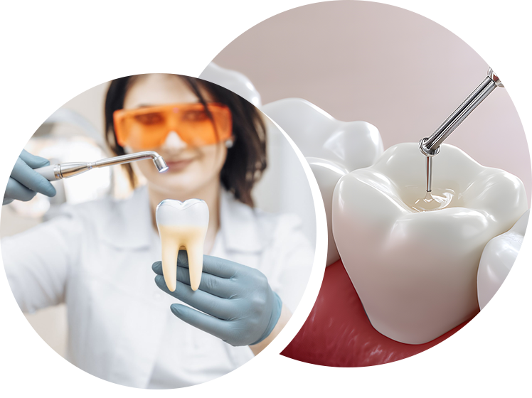 What Are the Advantages of White Fillings in London.