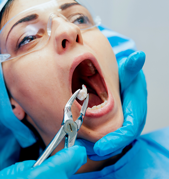 Wisdom Teeth Removal Surgery at Smile Clinic, London