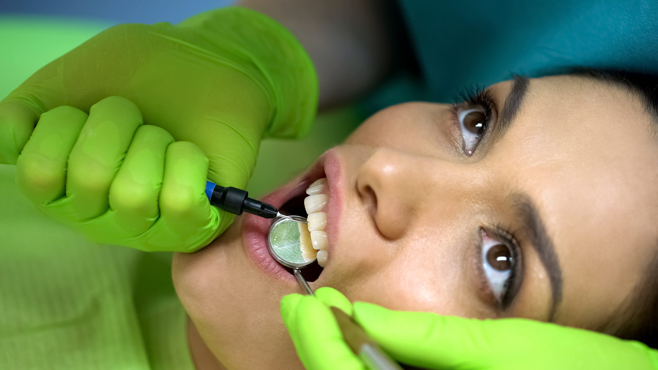 Chipped or Broken Teeth Treatment
