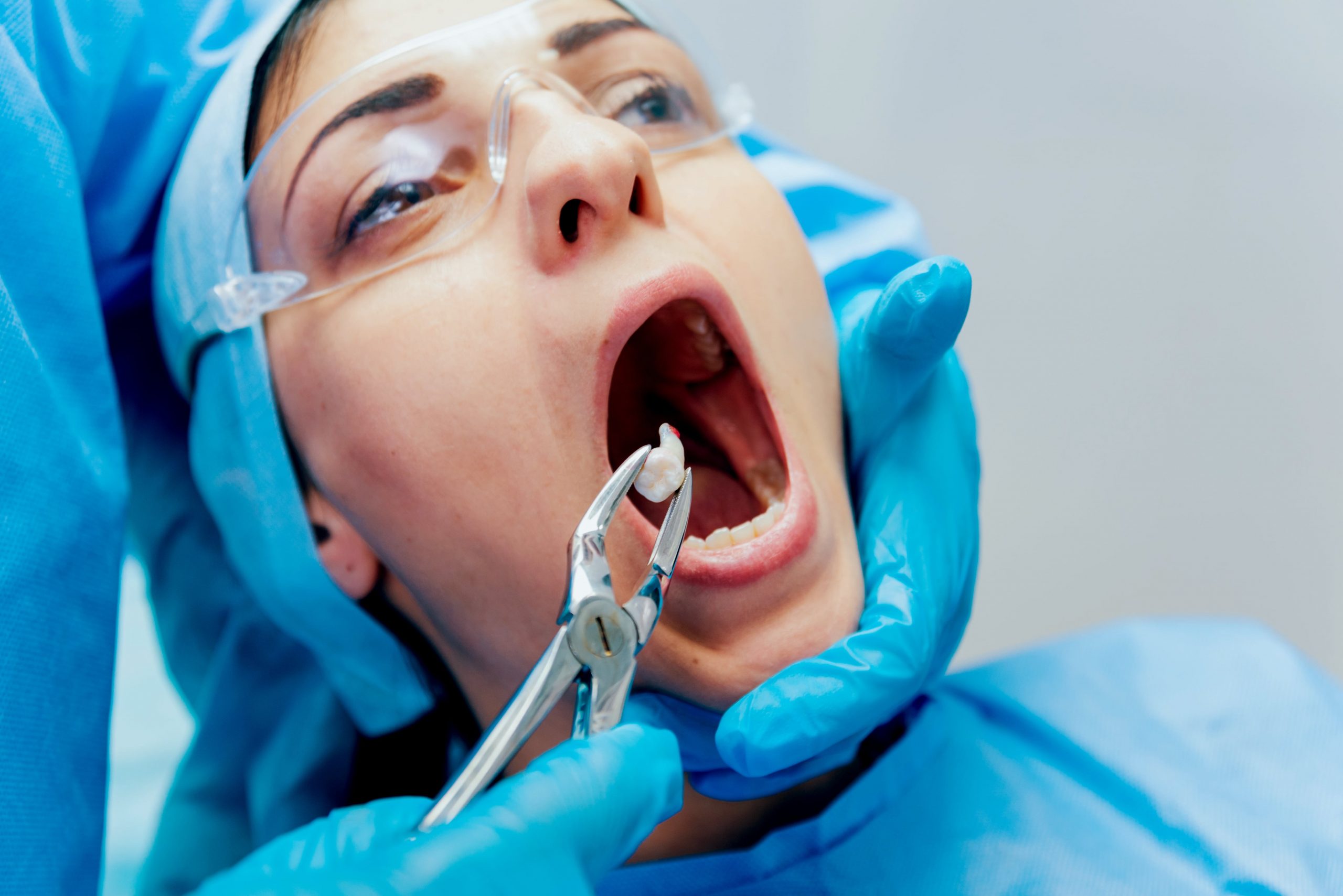 Wisdom Tooth Removal - Smile Clinic London