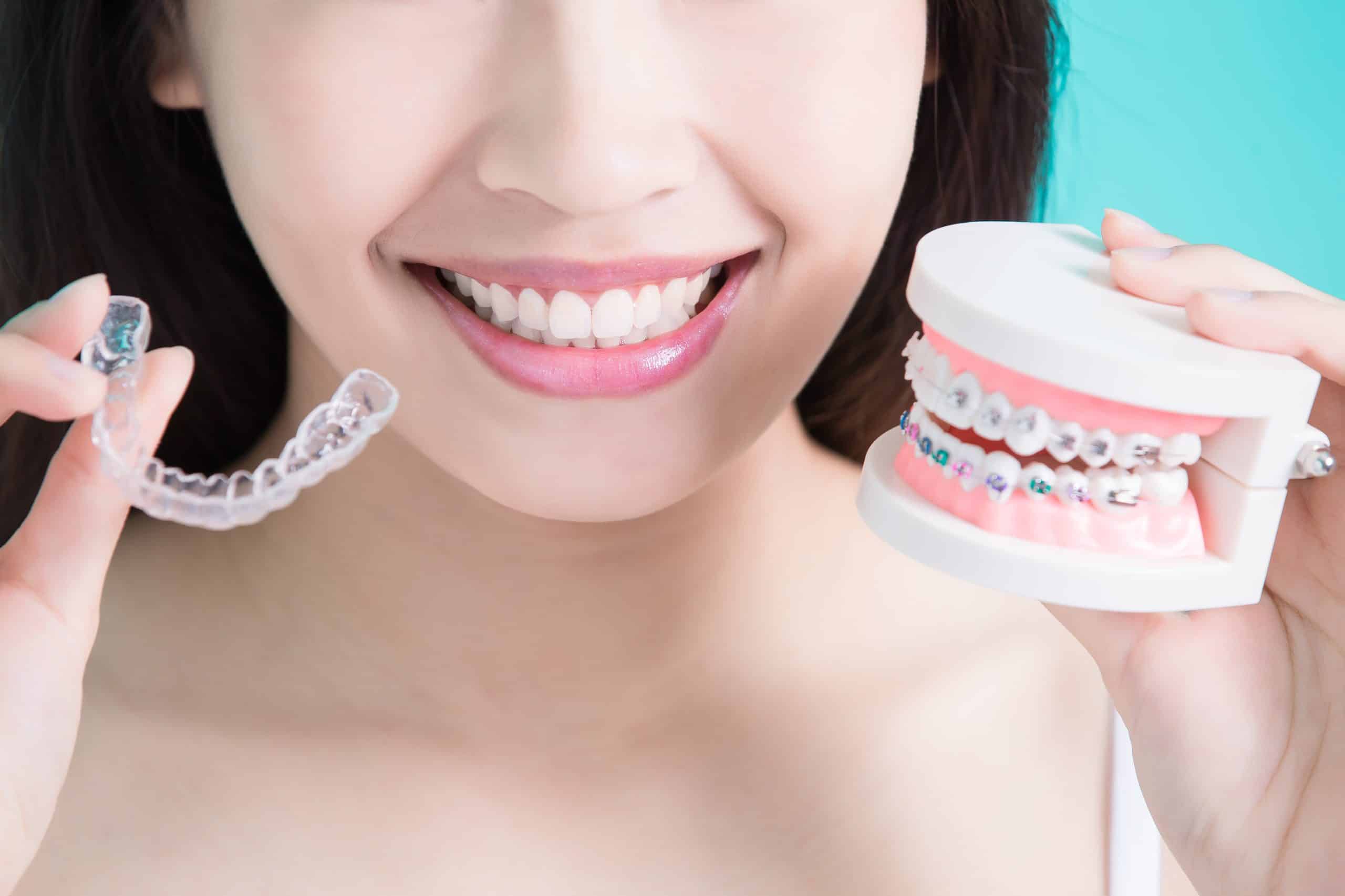 Clear Aligners as Treatment Contribution