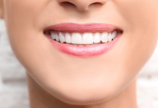 Beautiful smile with composite bonding