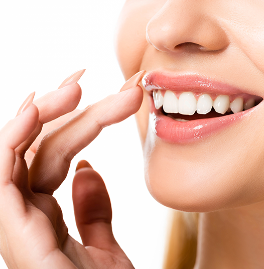 Indirect composite veneers